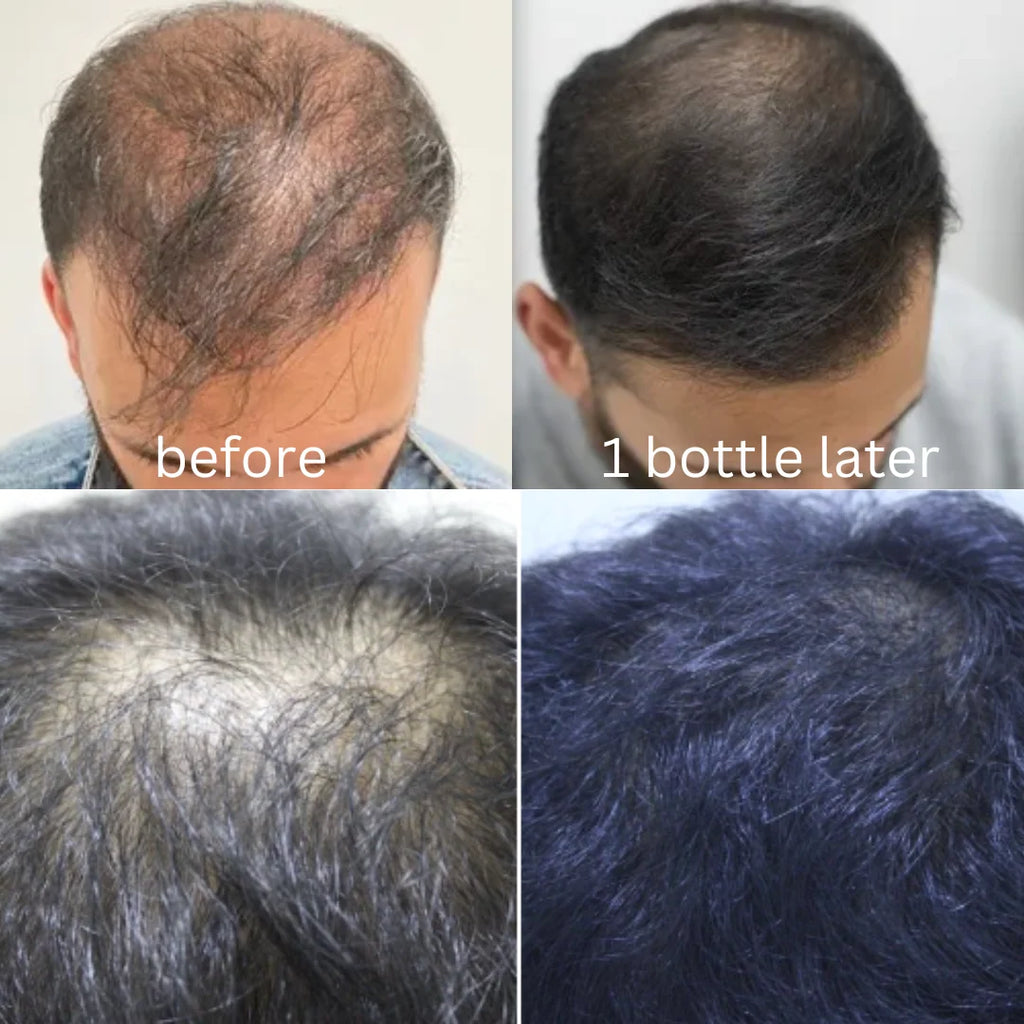 Herbal Oil - Get Shampoo Free