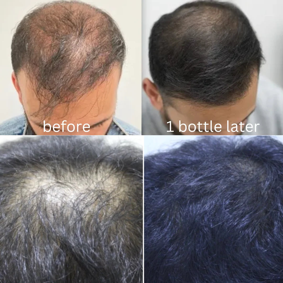 Herbal Oil - Get Shampoo Free